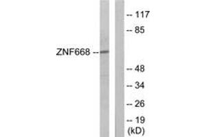 Western blot analysis of extracts from Jurkat cells, using ZNF668 Antibody. (ZNF668 抗体  (AA 271-320))