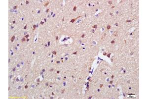 Formalin-fixed and paraffin embedded rat brain labeled with Anti-AKAP7 Polyclonal Antibody, Unconjugated (ABIN1387303) at 1:200 followed by conjugation to the secondary antibody and DAB staining (AKAP7 抗体  (AA 31-80))
