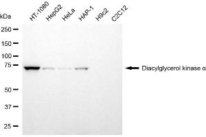 Western blotting analysis using diacylglycerol kinase alpha antibody (ABIN7798326). (DGKA 抗体)