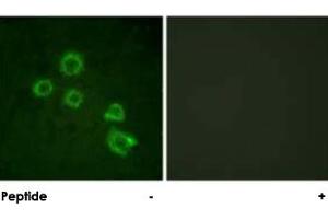 Immunofluorescence analysis of HUVEC cells, using PLA2G4A polyclonal antibody . (PLA2G4A 抗体)