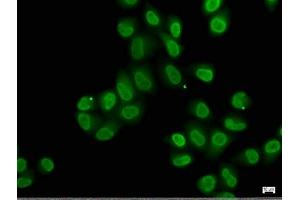 Immunofluorescence staining of Hela cells with ABIN7140239 at 1:50, counter-stained with DAPI. (Znf423 抗体  (AA 39-57))