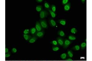 Immunofluorescence staining of Hela cells with ABIN7140239 at 1:50, counter-stained with DAPI. (Znf423 抗体  (AA 39-57))