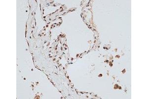 Immunohistochemistry (Paraffin-embedded Sections) (IHC (p)) image for anti-Zinc Finger Protein 148 (ZNF148) antibody (ABIN7262943)