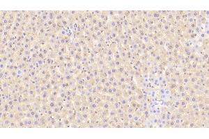Detection of TFR in Rat Liver Tissue using Polyclonal Antibody to Transferrin Receptor (TFR)