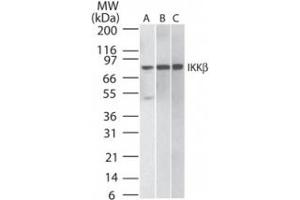 Image no. 1 for anti-Inhibitor of kappa Light Polypeptide Gene Enhancer in B-Cells, Kinase beta (IKBKB) antibody (ABIN208069) (IKBKB 抗体)