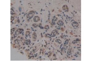 Immunohistochemistry (IHC) image for anti-Noggin (NOG) (AA 28-232) antibody (ABIN7426478)