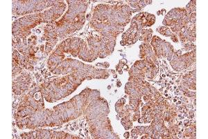 Immunohistochemistry (IHC) image for anti-Isocitrate Dehydrogenase 3 (NAD+) alpha (IDH3A) antibody (ABIN2855763)