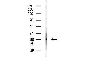anti-Abhydrolase Domain Containing 13 (ABHD13) (Internal Region) antibody