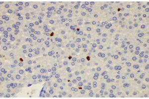 Immunohistochemistry of paraffin-embedded Rat liver using S100a8 Polycloanl Antibody at dilution of 1:200 (S100A8 抗体)