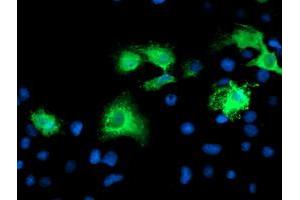 Anti-KATNB1 mouse monoclonal antibody (ABIN2455151) immunofluorescent staining of COS7 cells transiently transfected by pCMV6-ENTRY KATNB1 (RC201852). (KATNB1 抗体)