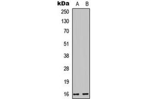 Western blot analysis of Cystatin E/M expression in HEK293T (A), PC12 (B) whole cell lysates. (CST6 抗体  (Center))