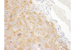 anti-DEAD (Asp-Glu-Ala-Asp) Box Polypeptide 3, X-Linked (DDX3X) (AA 1-50) antibody