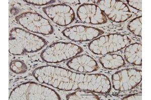 Image no. 1 for anti-Calcium and Integrin-Binding Protein 1 (CIB1) (AA 1-192) antibody (ABIN599142) (CIB1 抗体  (AA 1-192))