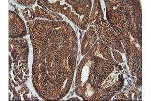 Image no. 1 for anti-Cyclin-Dependent Kinase Inhibitor 2B (p15, Inhibits CDK4) (CDKN2B) antibody (ABIN1497447) (CDKN2B 抗体)