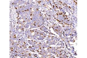 IHC analysis of Geminin/GMNN using anti-Geminin/GMNN antibody (ABIN7600598). (Geminin 抗体  (AA 21-196))