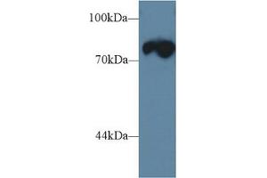 Western Blot; Sample: Mouse Skeletal muscle lysate; Primary Ab: 1µg/ml Rabbit Anti-Rat TRDN Antibody Second Ab: 0. (Triadin 抗体  (AA 486-687))
