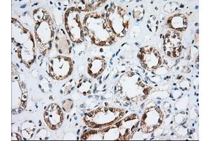 Immunohistochemical staining of paraffin-embedded Human Kidney tissue using anti-IGF2BP2 mouse monoclonal antibody. (IGF2BP2 抗体)