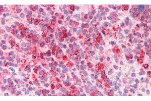 Immunohistochemistry (IHC) image for anti-Azurocidin 1 (AZU1) (AA 23-247) antibody (ABIN7433654)