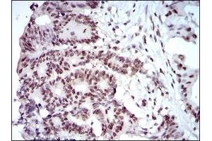 anti-Mitogen-Activated Protein Kinase 7 (MAPK7) (AA 411-556) antibody