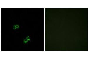 Immunofluorescence analysis of MCF-7 cells, using MC5R antibody. (MC5 Receptor 抗体  (C-Term))