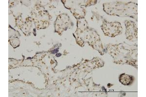Immunostaining (ISt) image for anti-Ets Variant 6 (ETV6) (AA 1-452) antibody (ABIN560810)