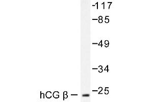 Image no. 1 for anti-Chorionic Gonadotropin (hCG) antibody (ABIN265452) (hCG 抗体)