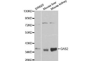 Western blot analysis of extracts of various cell lines, using GAS2 antibody (ABIN5970514) at 1/1000 dilution. (GAS2 抗体)