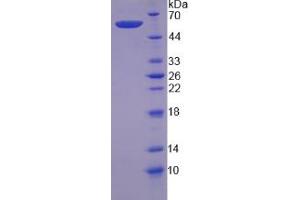 SDS-PAGE analysis of Human CAPN6 Protein. (Calpain 6 Protein (CAPN6))