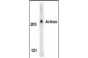 Western blot analysis of Acinus in K562 whole cell lysate with Acinus antibody (IN) at 1μg/ml.