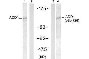 Western blot analysis of extract from HT-29 cells untreated or treated with Doxorubicin (1mM, 30min), using ADD1 (Ab-726) antibody (E021189, Lane 1 and 2) and ADD1 (Phospho- Ser726) antibody (E011182, Lane 3 and 4). (alpha Adducin 抗体  (pSer726))