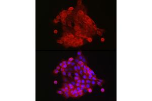 Immunofluorescence analysis of  cells using S100 Rabbit pAb (842) at dilution of 1:150 (40x lens). (S100A9 抗体  (AA 1-114))