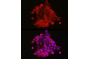 Immunofluorescence analysis of  cells using S100 Rabbit pAb (842) at dilution of 1:150 (40x lens). (S100A9 抗体  (AA 1-114))