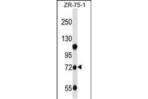 Western blot analysis in ZR-75-1 cell line lysates (35ug/lane). (Glucuronidase beta 抗体  (C-Term))