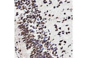 Immunohistochemistry (IHC) image for anti-High Mobility Group Box 1 (HMGB1) (AA 100-200) antibody (ABIN3023358) (HMGB1 抗体  (AA 100-200))