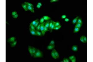 Immunofluorescence staining of HepG2 cells with ABIN7145444 at 1:233, counter-stained with DAPI. (beta Arrestin 1 抗体  (AA 1-260))