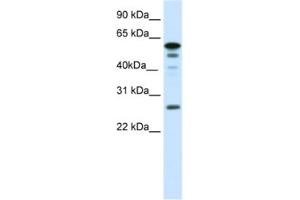 Western Blotting (WB) image for anti-Forkhead Box D1 (FOXD1) antibody (ABIN2461434) (FOXD1 抗体)