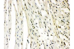 Anti- SLUG Picoband antibody,IHC(P) IHC(P): Rat Cardiac Muscle Tissue (SLUG 抗体  (Middle Region))