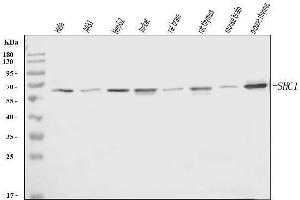 Western blot analysis of SHC1 using anti-SHC1 antibody (ABIN7602798).