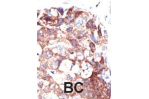 Immunohistochemistry (IHC) image for anti-Ubiquilin 1 (UBQLN1) antibody (ABIN3001493) (Ubiquilin 1 抗体)