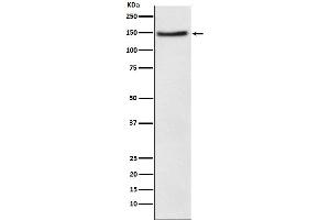 Western blot analysis of Niemann Pick C1 Like 1 expression in HeLa cell lysate.