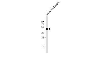 Anti-FAT1 Antibody at 1:2000 dilution + recombinant protein Lysates/proteins at 20 μg per lane. (FAT1 抗体  (AA 4203-4539))