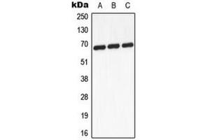 Western blot analysis of GCKR expression in A431 (A), mouse heart (B), PC12 (C) whole cell lysates. (GCKR 抗体  (Center))