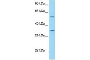 Image no. 1 for anti-HLA Class I Histocompatibility Antigen, alpha Chain E (HLA-E) (AA 158-207) antibody (ABIN6748101)