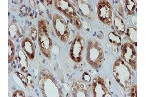 Immunohistochemical staining of paraffin-embedded Human Kidney tissue using anti-SAT2 mouse monoclonal antibody. (SAT2 抗体)