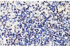 Immunohistochemistry of paraffin-embedded Rat spleen using Acetyl-Histone H2B-K5 Polyclonal Antibody at dilution of 1:100 (40x lens). (Histone H2B 抗体  (acLys5))