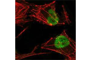 Confocal immunofluorescence analysis of Hela cells using MSH2 mouse mAb (green), showing nuclear localization. (MSH2 抗体)