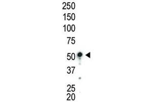 Western blot analysis of AMPK antibody and mouse liver lysate (PRKAA1 抗体  (AA 479-510))