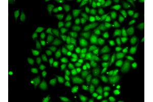Immunofluorescence (IF) image for anti-CCCTC-Binding Factor (Zinc Finger Protein)-Like (CTCFL) antibody (ABIN1877135) (CTCFL 抗体)