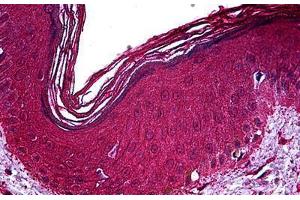 Immunohistochemistry (Formalin-fixed Paraffin-embedded Sections) (IHC (fp)) image for anti-Nuclear Receptor Subfamily 2, Group C, Member 2 (NR2C2) (AA 43-153) antibody (ABIN626187)