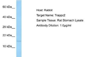 Host: Rabbit Target Name: TRAPPC2 Sample Tissue: Rat Stomach Antibody Dilution: 1ug/ml (TRAPPC2 抗体  (N-Term))